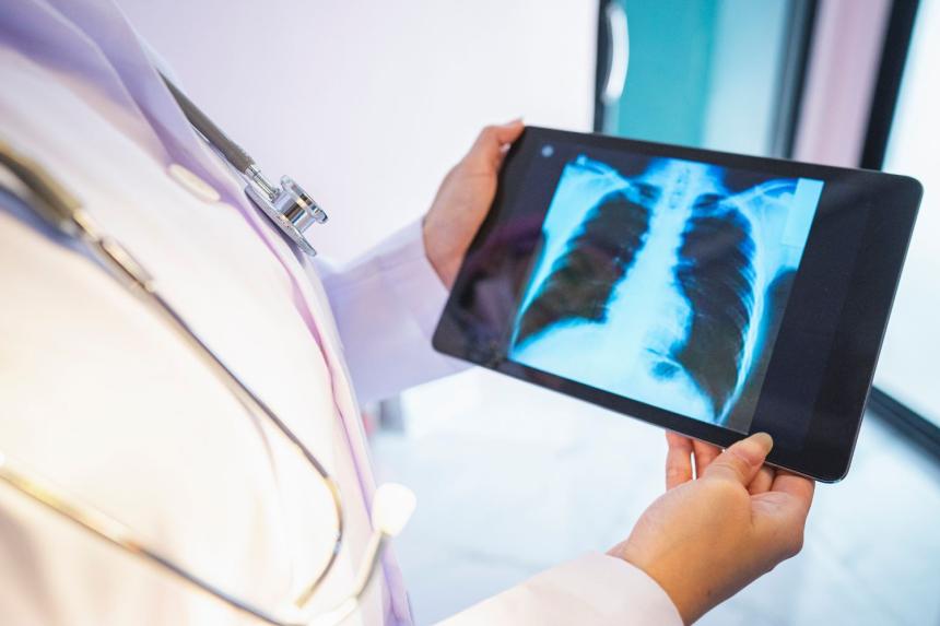 Robotic surgery for lung cancer Innovative approach may offer shorter